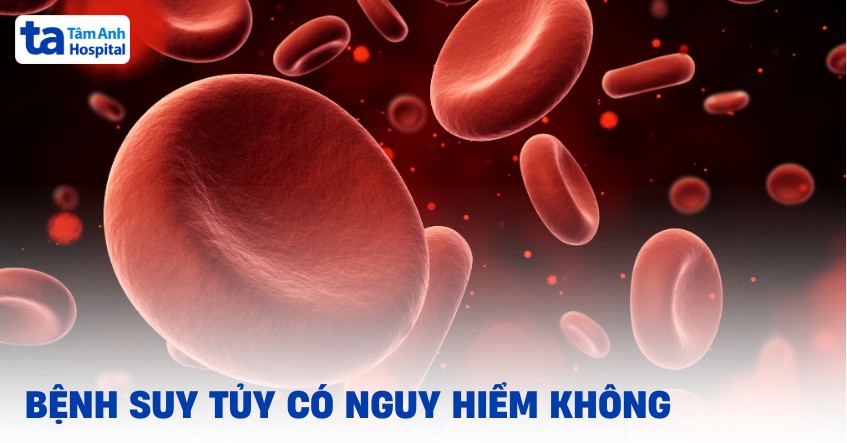 Bệnh suy tủy có nguy hiểm không? Lưu ý các biến chứng thường gặp