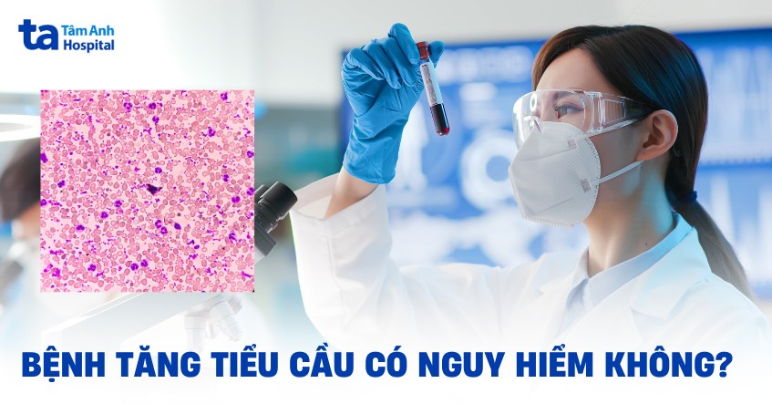 bệnh tăng tiểu cầu có nguy hiểm không