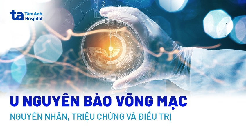 u nguyên bào võng mạc
