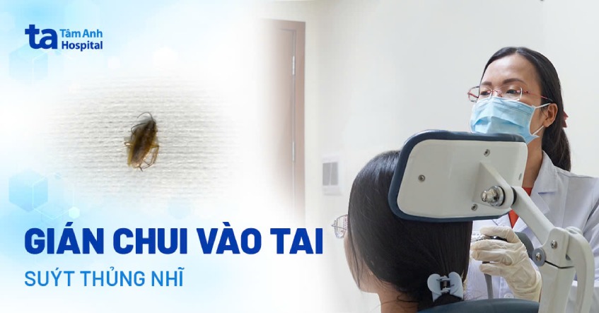 bị gián chui vào tai