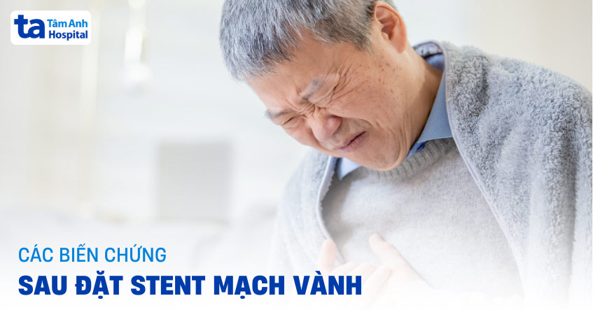 11 biến chứng sau đặt stent mạch vành cần theo dõi để cảnh giác