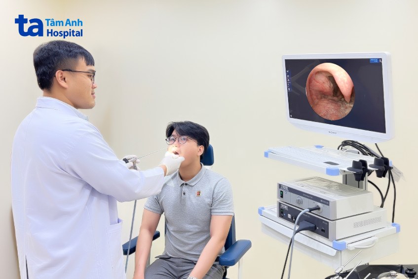 bs nội soi xương cá đâm amidan