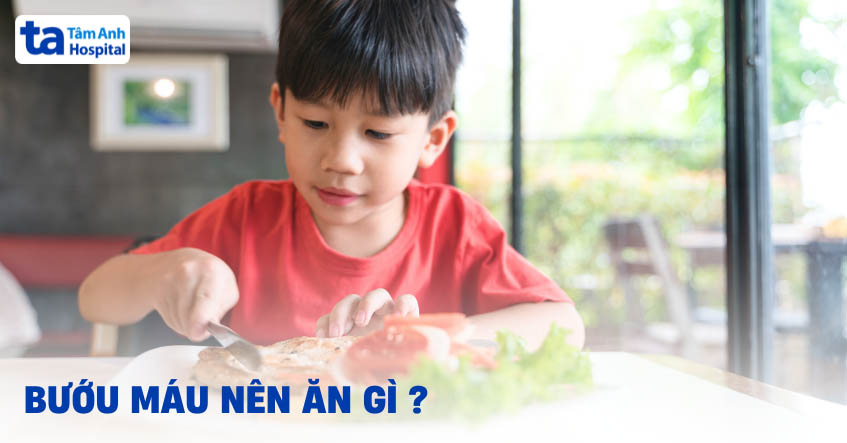 Bướu máu nên ăn gì, kiêng ăn gì an toàn và mau khỏe?
