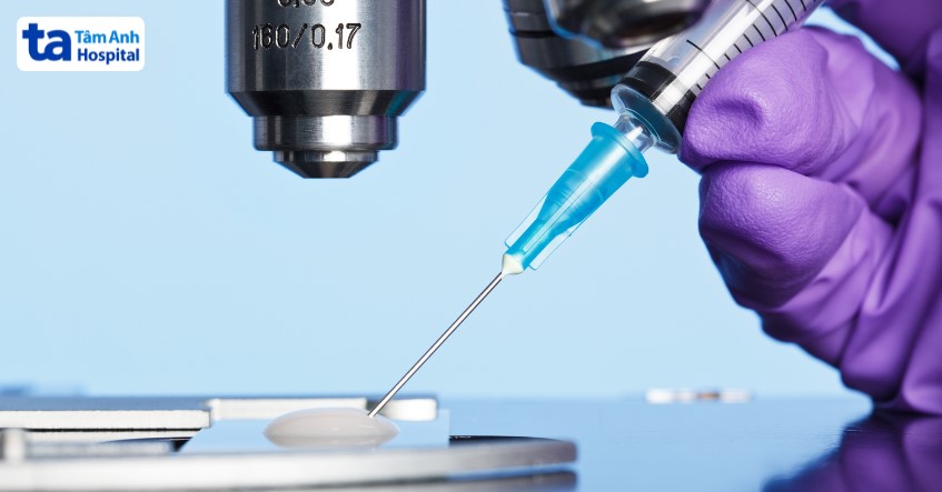 Các phương pháp xét nghiệm tinh trùng hiện nay