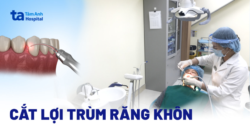 Chi phí cắt lợi trùm răng khôn bao nhiêu tiền? Có nên không?