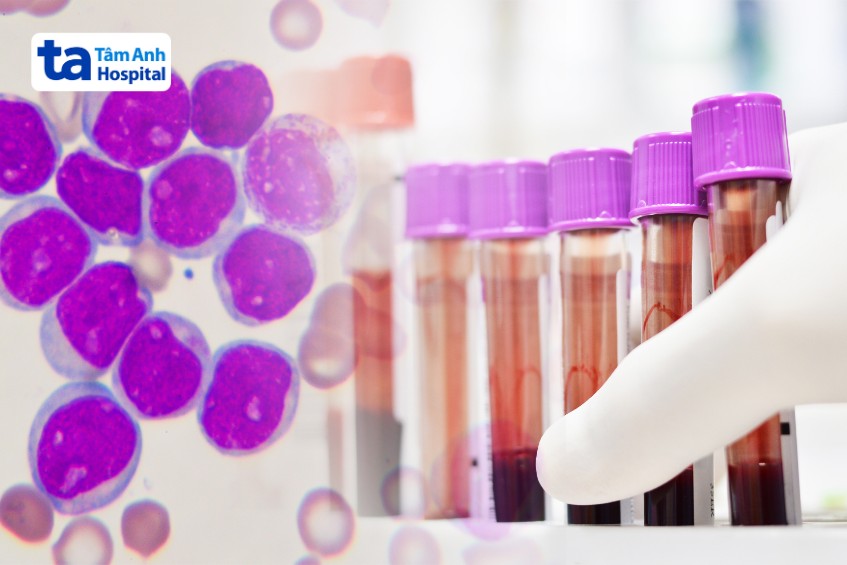 chẩn đoán bạch cầu cấp