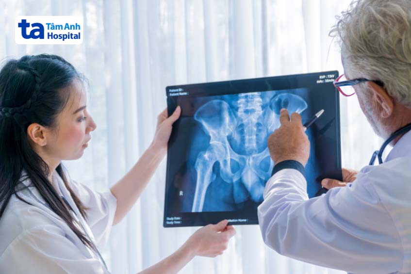 chẩn đoán đau khớp háng ở trẻ em