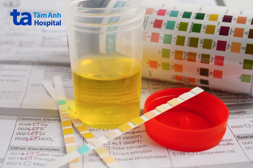 chẩn đoán tình trạng tiểu buốt ra máu ở nam giới