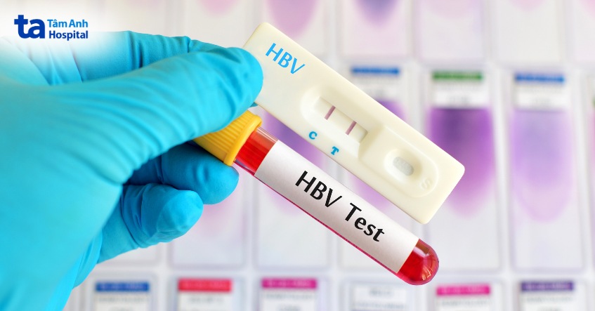 chẩn đoán viêm cầu thận tăng sinh màng