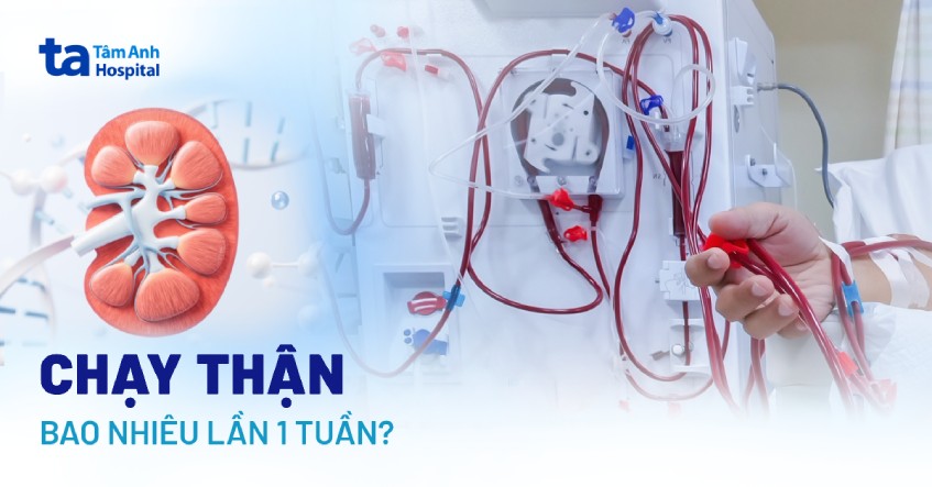 Chạy thận bao nhiêu lần 1 tuần là phù hợp ở bệnh nhân suy thận?