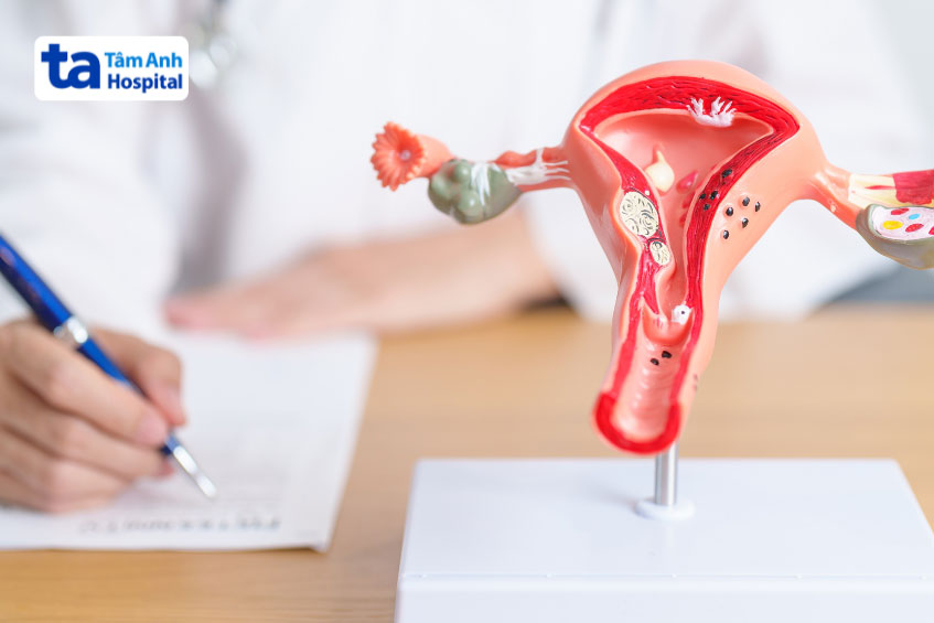 chỉ định điều trị ung thư phù hợp