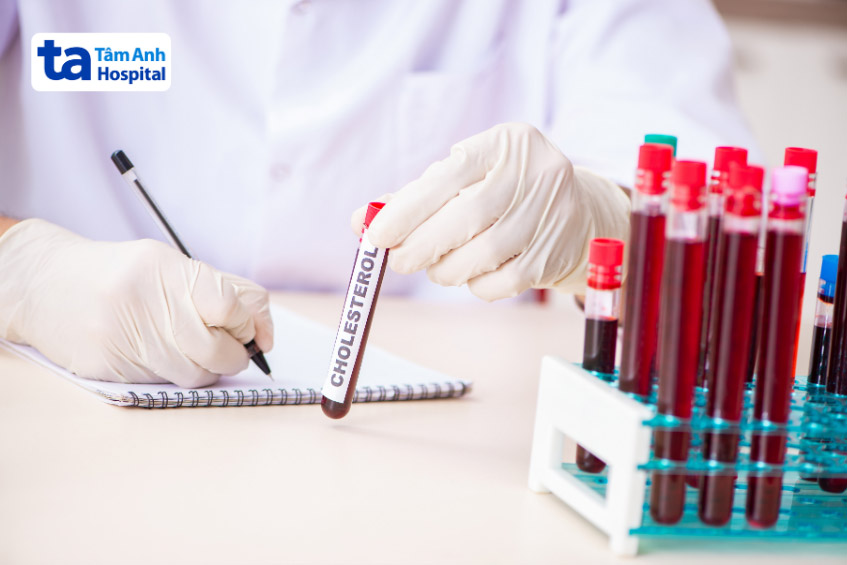 Chri số chẩn đoán nguy cơ tim mạch