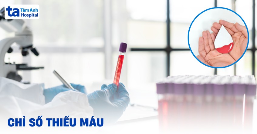 Chỉ số thiếu máu bao nhiêu là được chẩn đoán đang mắc bệnh?