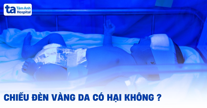 Chiếu đèn vàng da có hại không? Tác dụng phụ ảnh hưởng đến trẻ