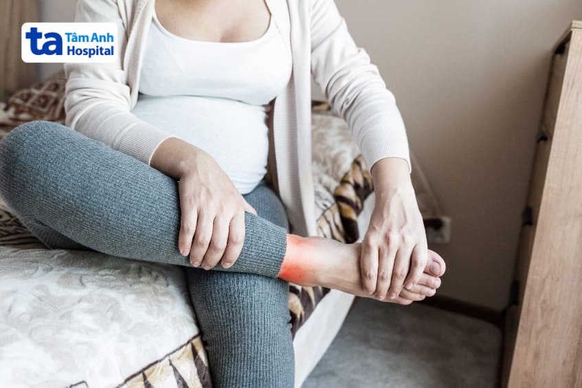 Chuột rút là triệu chứng thường gặp khi mang thai ở tuần 19