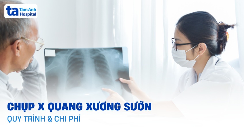 Chụp X quang xương sườn bao nhiêu tiền? Quy trình và ở đâu tốt?