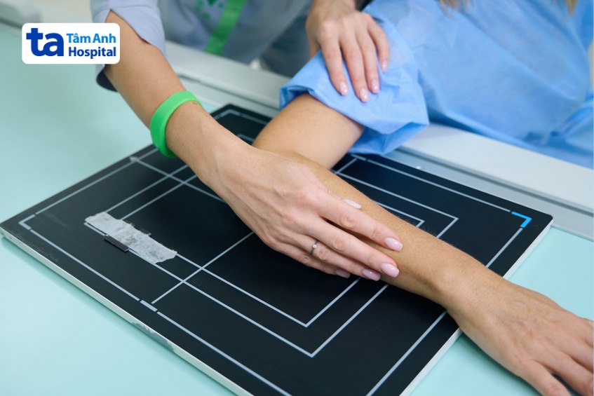 chụp x quang khuỷu tay ở đâu