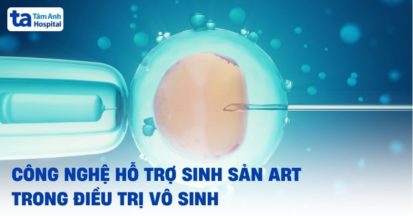 Công nghệ hỗ trợ sinh sản (ART) là gì? Vai trò, ứng dụng trong vô sinh