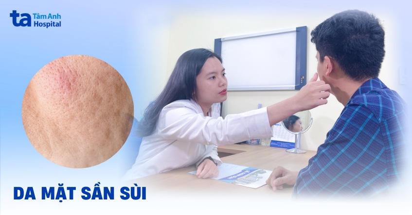 da mặt sần sùi