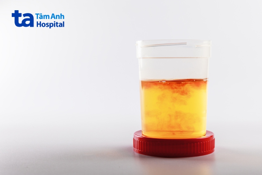 dấu hiệu tiểu buốt ra máu ở nam giới