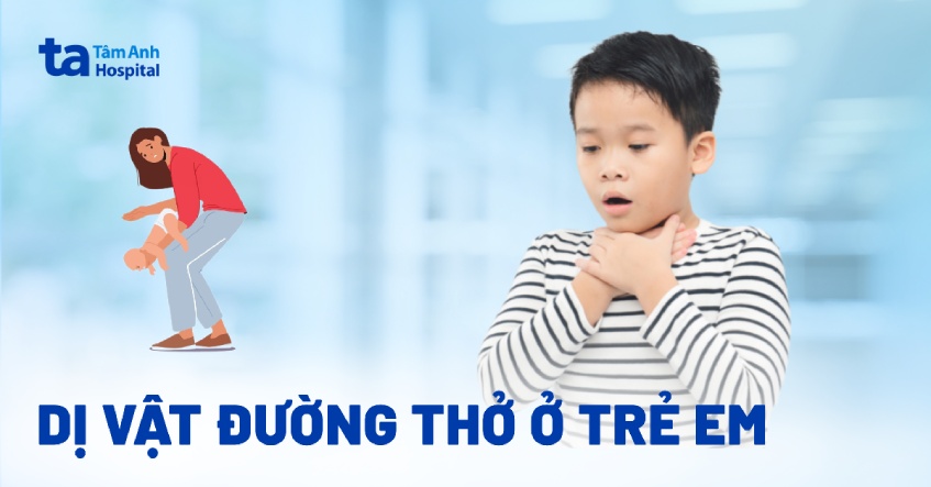 Dị vật đường thở ở trẻ em: Nguyên nhân, triệu chứng, phòng ngừa