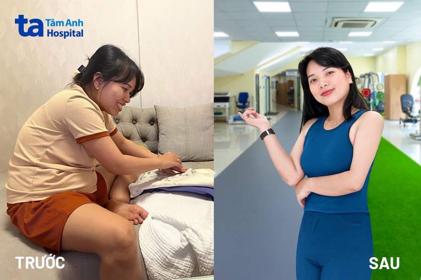 điều trị chất béo nội tạng