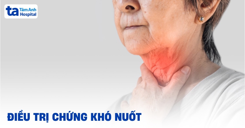 3 phương pháp điều trị chứng khó nuốt hiệu quả, an toàn