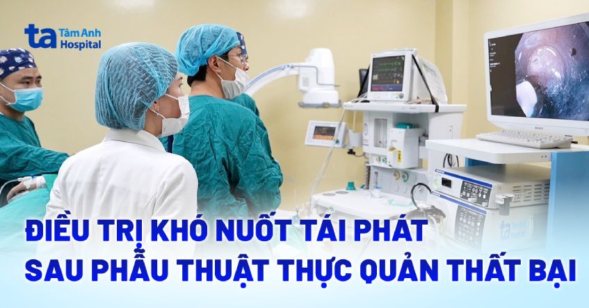 Điều trị khó nuốt tái phát sau phẫu thuật thực quản thất bại