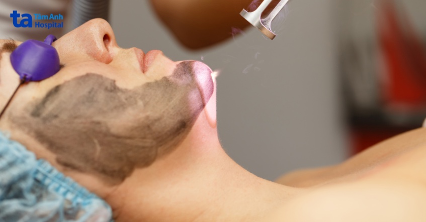 điều trị mụn cứng dưới da