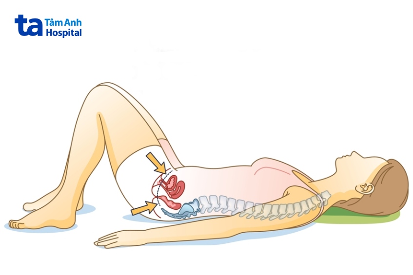 điều trị sa bàng quang nữ