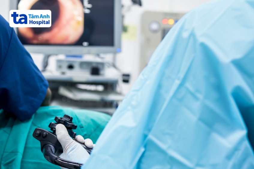 điều trị trào ngược dạ dày