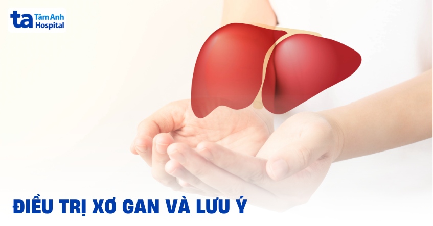 11 cách điều trị xơ gan thường dùng hiệu quả cao và an toàn