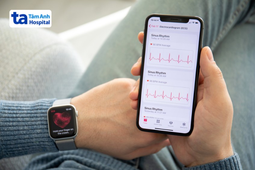 đồng hồ và điện thoại có tích hợp ecg đo nhịp tim