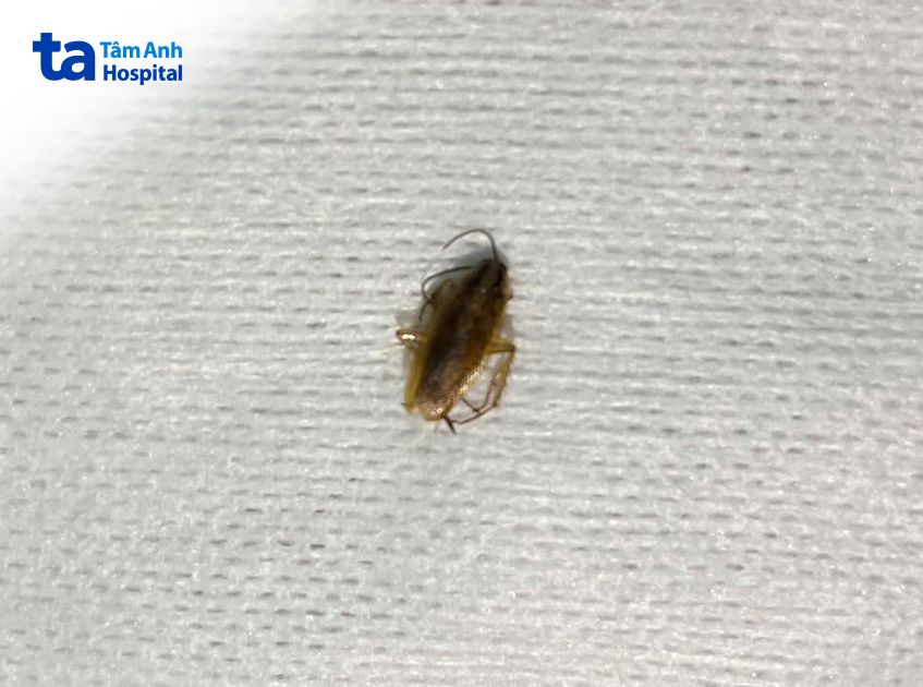 gián được gắp ra