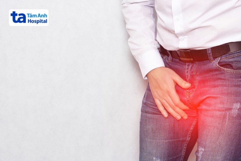 Giãn tĩnh mạch thừng tinh có tự khỏi được không?