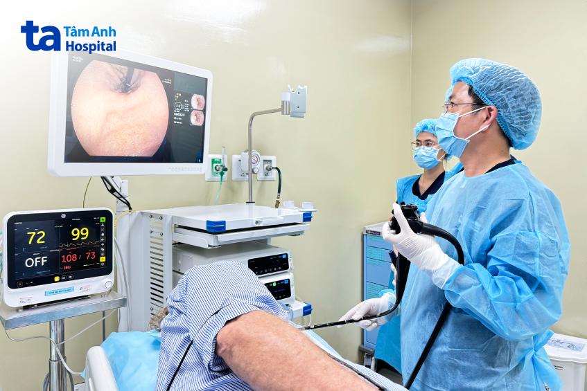 hình ảnh nội soi phun bột