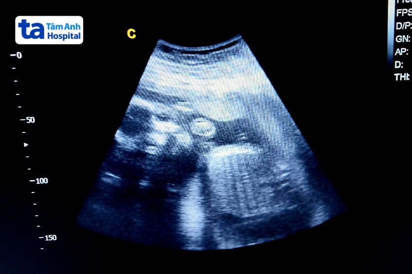 Hình dáng và kích thước của thai 19 tuần tuổi khi siêu âm