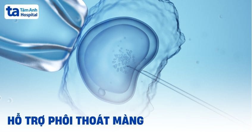 Hỗ trợ phôi thoát màng