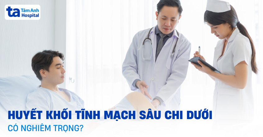 Huyết khối tĩnh mạch sâu chi dưới: Nguyên nhân, triệu chứng, chẩn đoán