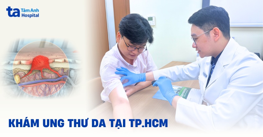 Địa chỉ khám ung thư da tại TPHCM ở đâu tốt và uy tín?