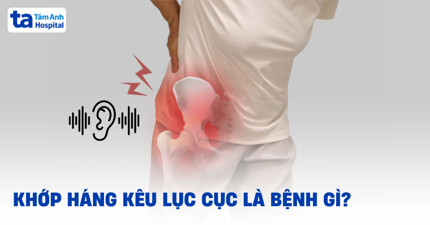 Khớp háng kêu lục cục, lộp cộp là bệnh gì? Cách chữa như thế nào?