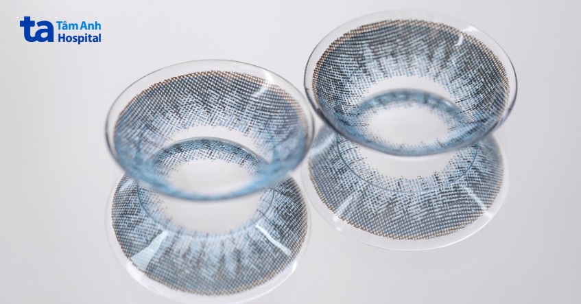 kính áp tròng là kính gì? kính áp tròng cải thiện thẩm mỹ