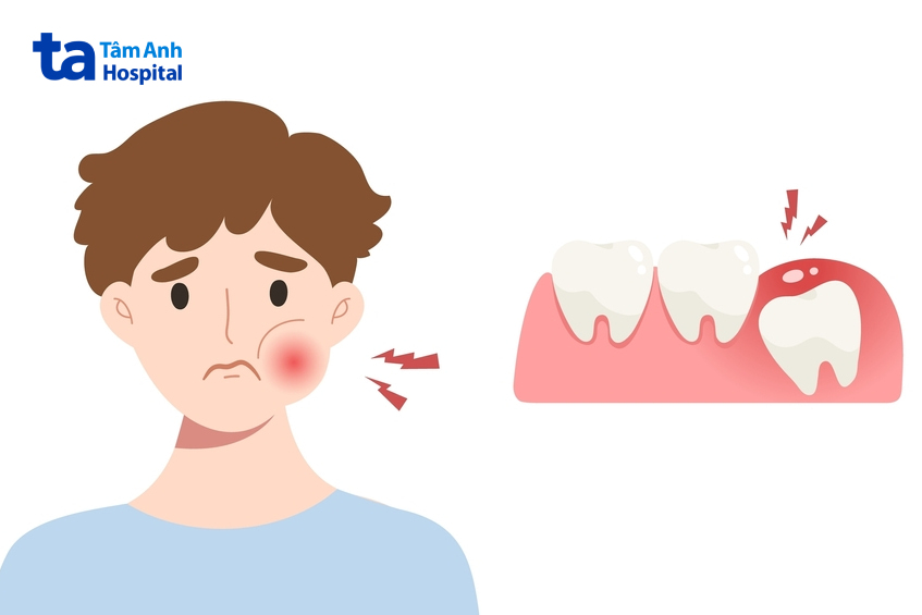 Cắt lợi trùm có nguy hiểm không?