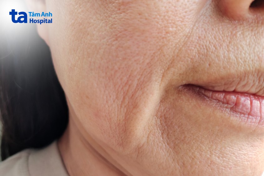 lão hóa da là nguyên nhân