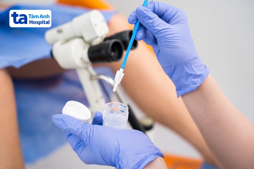lấy mẫu bệnh phẩm trong quy trình xét nghiệm hpv