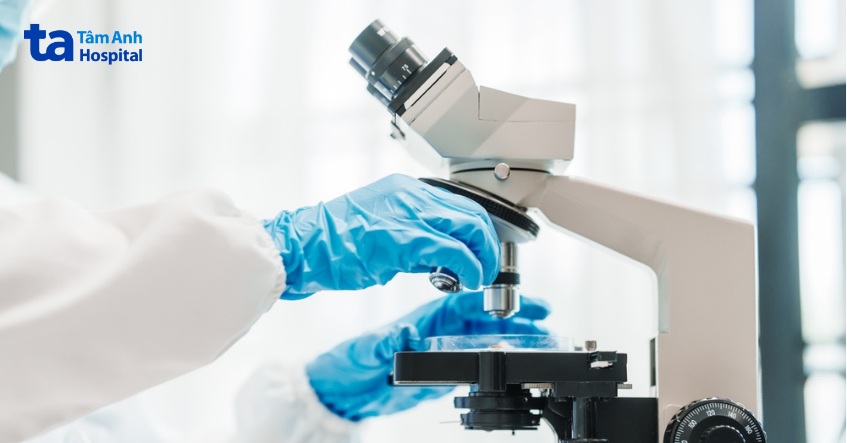 lưu ý khi điều trị ung thư bàng quang