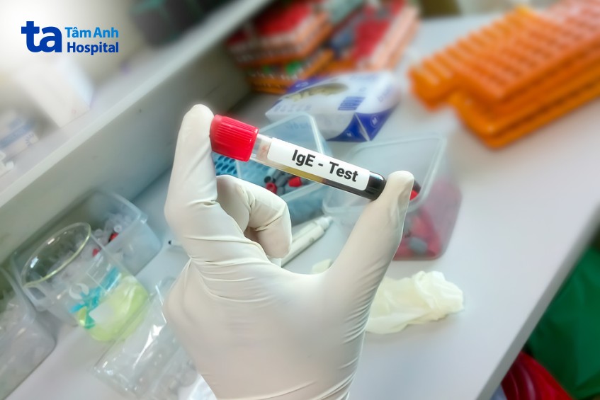 lưu ý khi xét nghiệm 36 dị nguyên