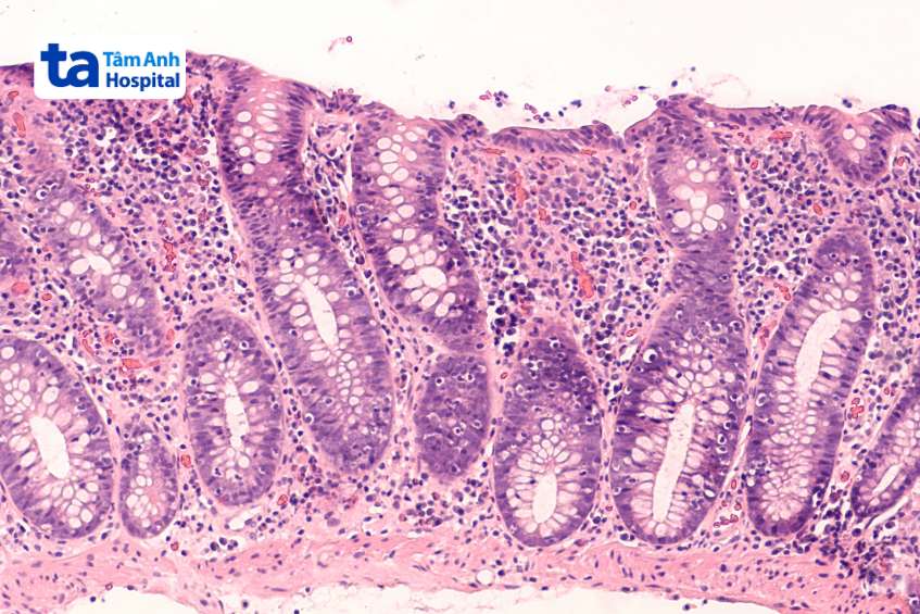 lympho b trong hệ miễn dịch thích ứng