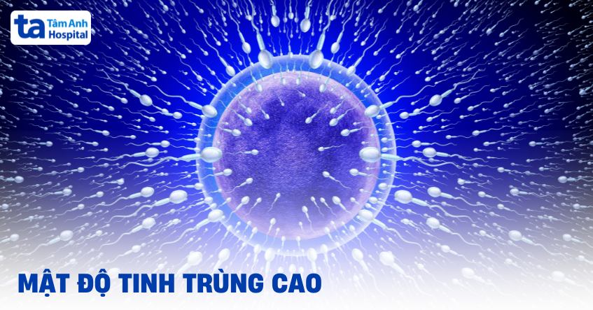 Mật độ tinh trùng cao có tốt không? Duy trì ở mức nào là ổn?