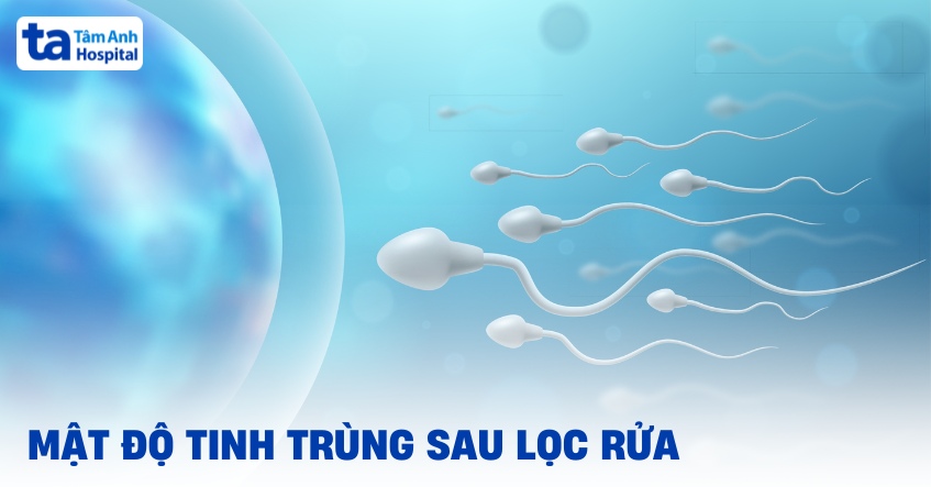 Mật độ tinh trùng sau lọc rửa bao nhiêu là tốt? Thông tin cần biết